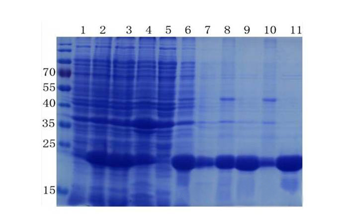 蛋白质提取与纯化技巧——esball生物医药