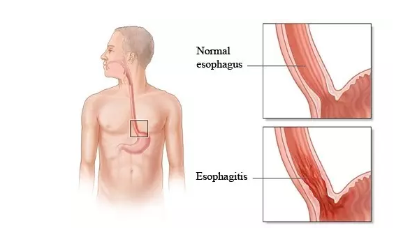 esball(中国区)官方网站