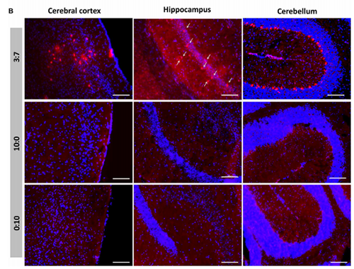 被包裹在含有NT-类脂质的LNP中的Cre沉组酶成功转移。大脑中的转染神经元呈红色高亮。