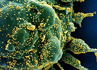 唾液检测新冠抗体新步骤来了，获取了局仅需几幼时！