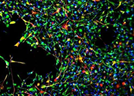 世界初创：药物将干细胞疏导至受损部位，提高其愈合能力！