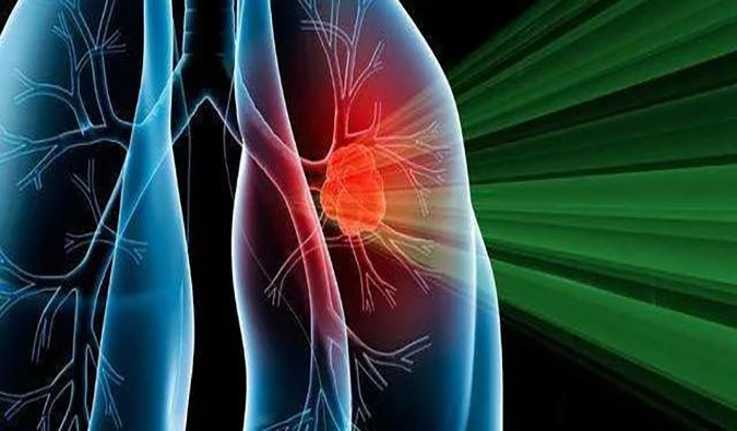 盛世泰科1类创新药物CGT-9475实现中美双报双批 | esball一站式临床前生物医药研发服务平台助力