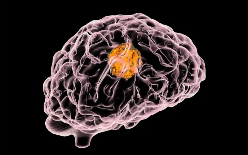 esball助力 | 璧辰医药ABM-1310获美国FDA孤儿药资格认证，用于医治携带BRAF V600突变的脑胶质母细胞瘤患者