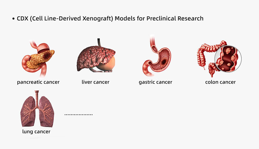人源肿瘤细胞系异种移植（CDX）模型在临床前钻研中的利用